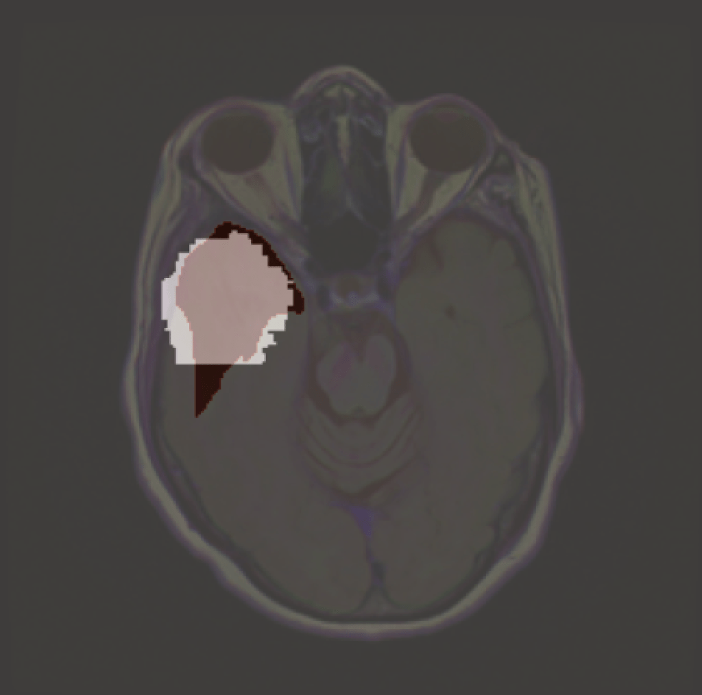 What is Explainable AI for Biomedical&nbsp;applications?